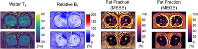 Fast Open-Source Toolkit for Water T2 Mapping in the Presence of Fat From Multi-Echo Spin-Echo Acquisitions for Muscle MRI